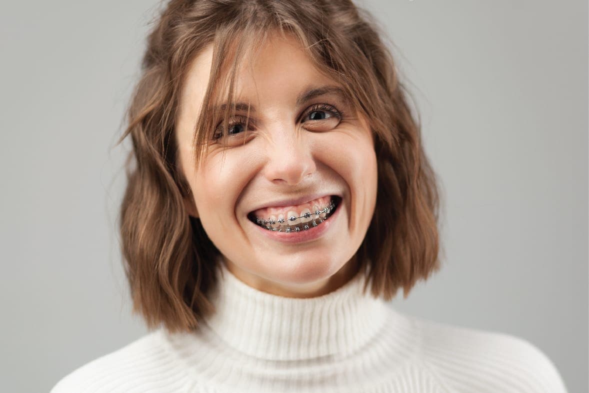 Braces for Adults