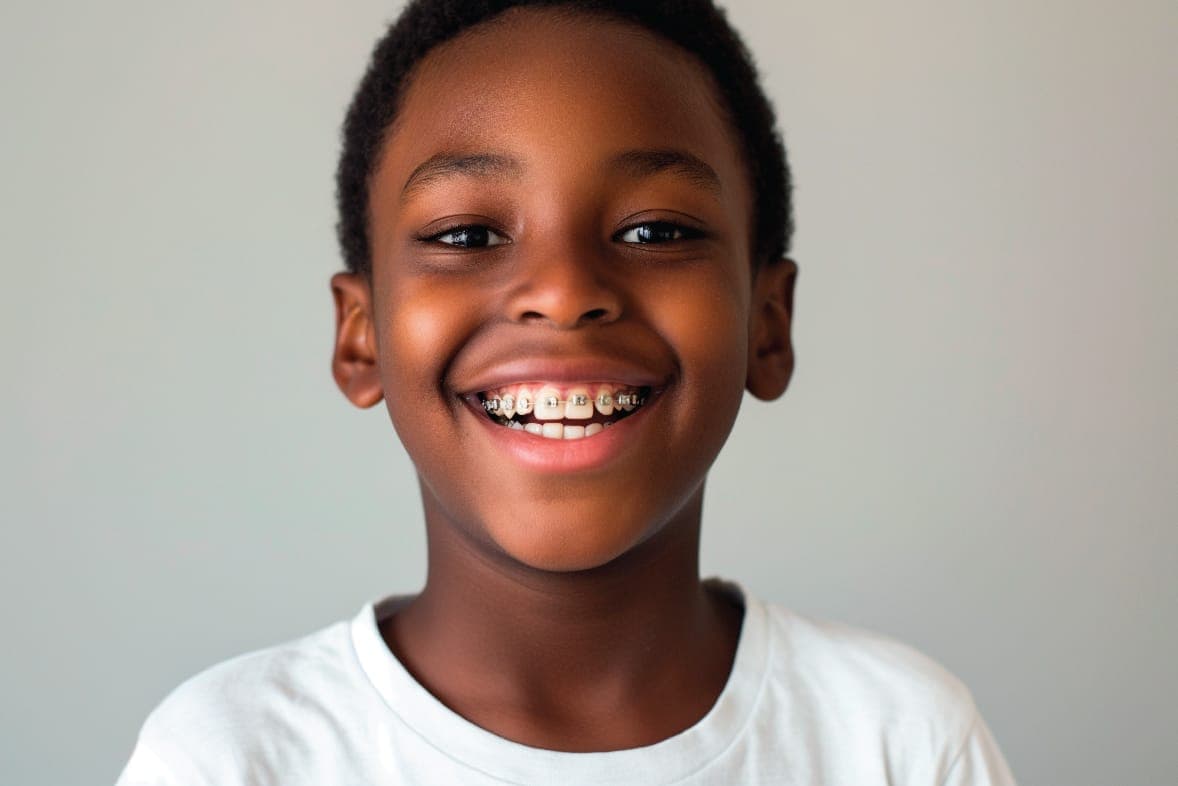 Braces for Kids