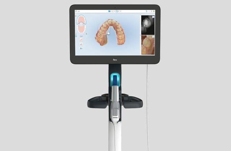 iTero 3D intraoral scanner displaying a digital model of teeth